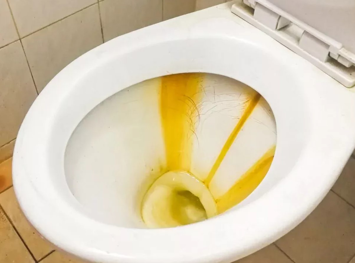 Portselantroon kollase kattega? Ootamatu vahend köögist eemaldab kivi ja annab läike